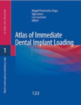 atlas immediate dental implant loading