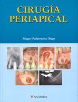 cirugia periapical