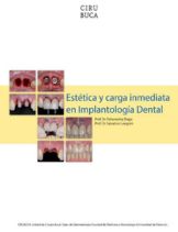 estetica carga inmediata implantologia dental